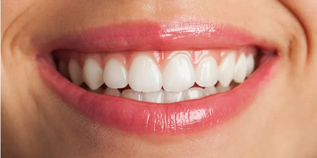 10 Benefit of Professional Teeth Whitening You Should Know