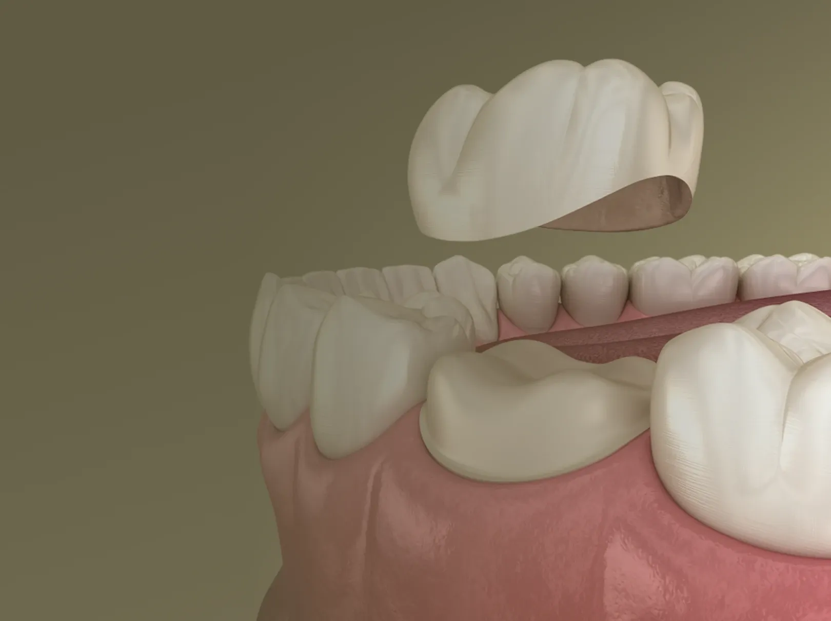 Background dental image