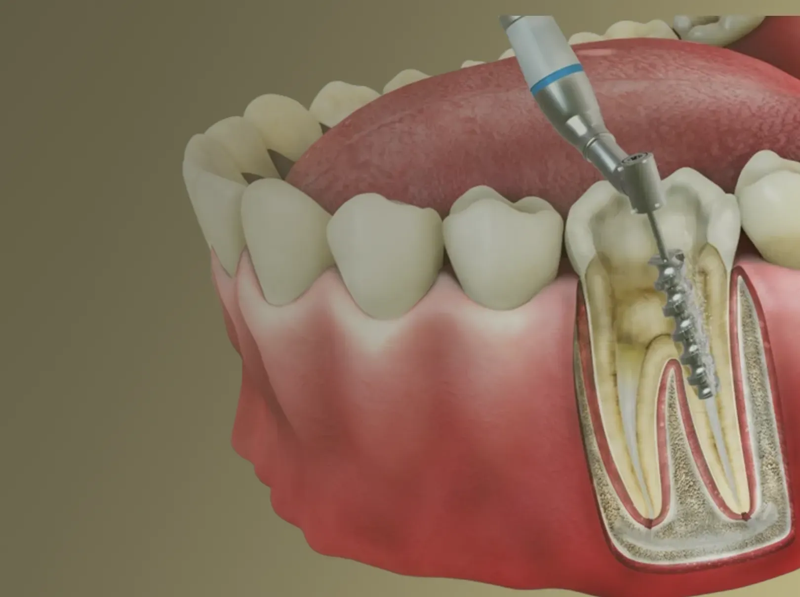Background dental image