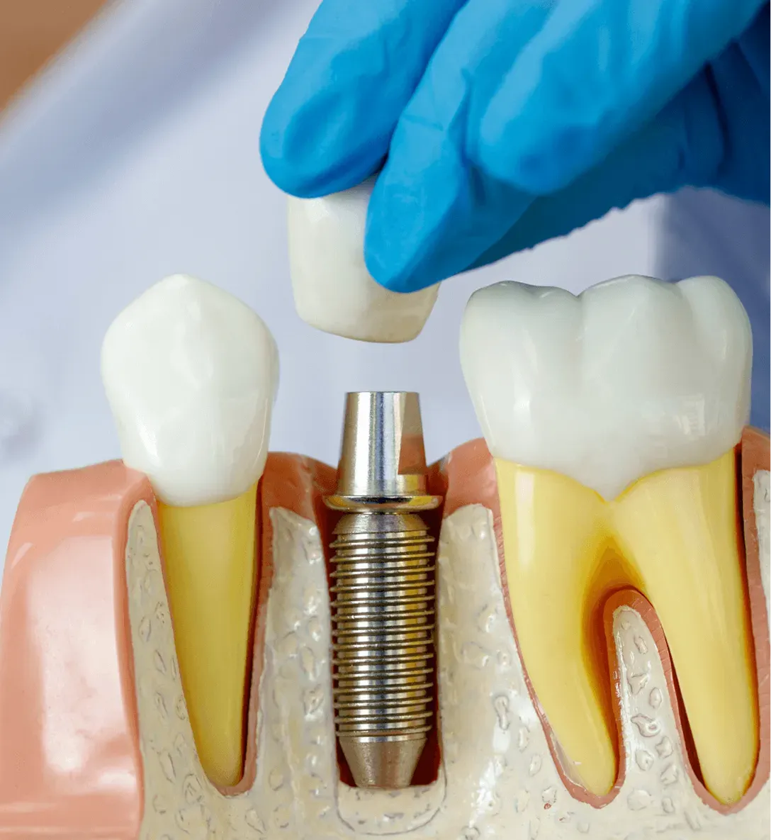 Dental Patient Smiling